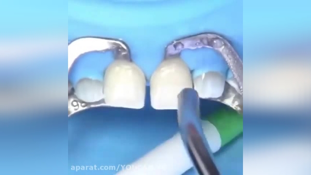 راهکار هایی برای داشتن دندان سفید و زیبا