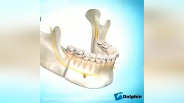 دانلود ویدیو ای از ارتودنسی دندان زیبایی