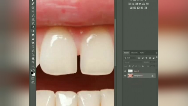 آموزش کامل پر کردن فاصله بین دندان ها در فتوشاپ برای زیباسازی